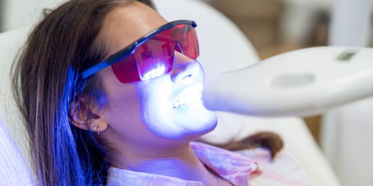 sbiancamento denti